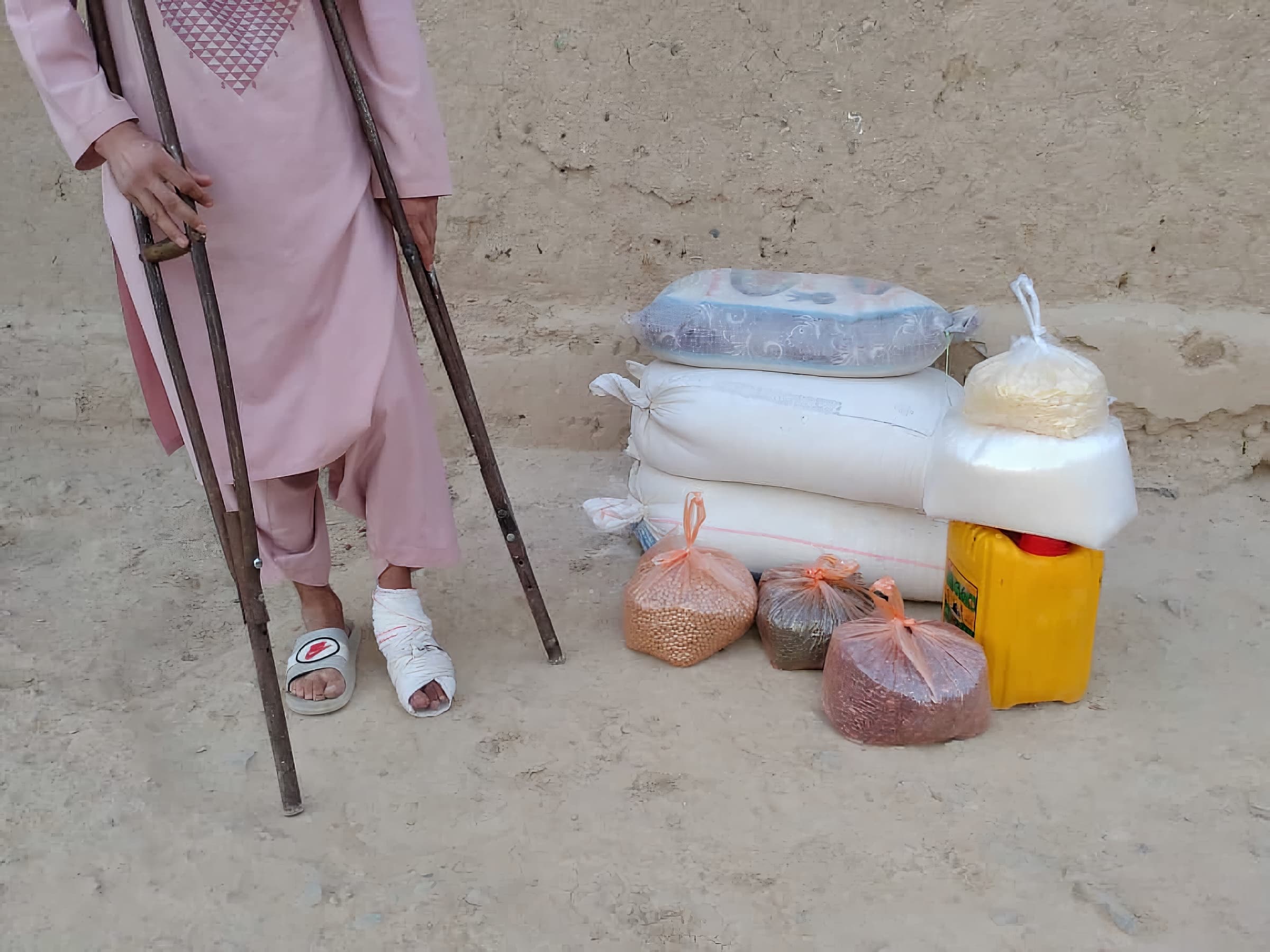 Father Loses Leg Due Lack of Medical Care