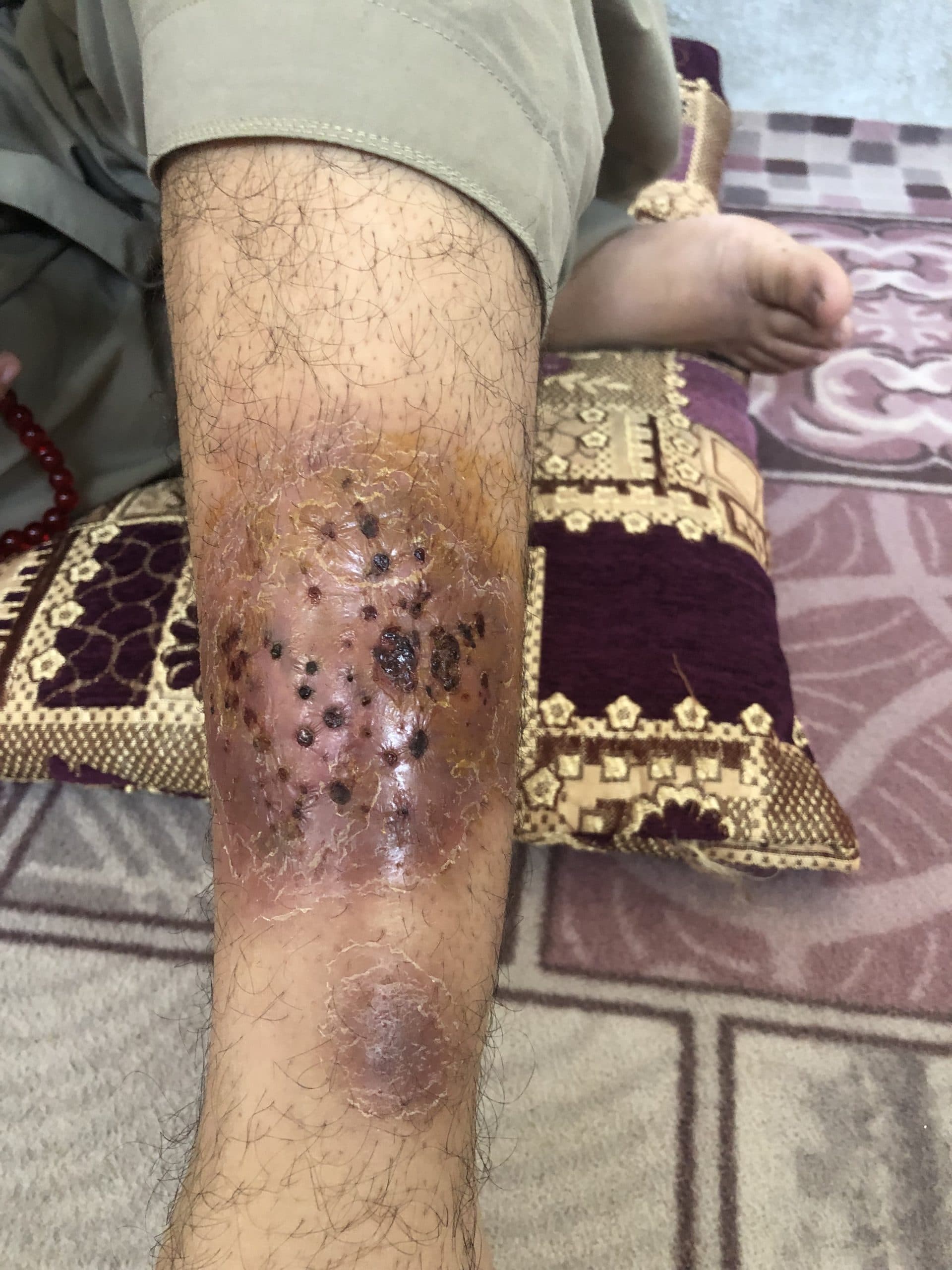 Help a tailor get Back on His Feet